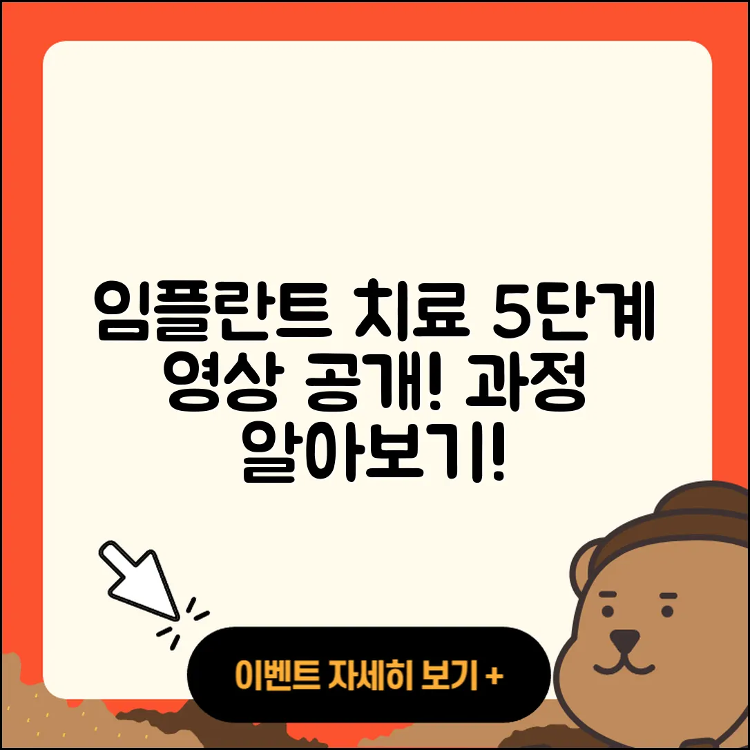 임플란트 치료 영상으로 배우는 5가지 과정