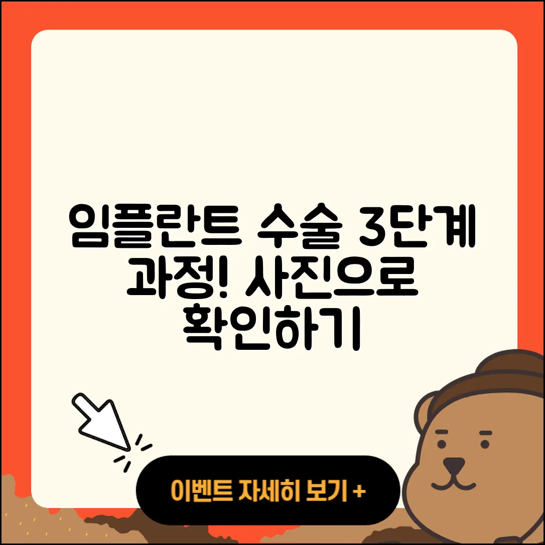 임플란트 수술 사진으로 알아보는 3가지 과정